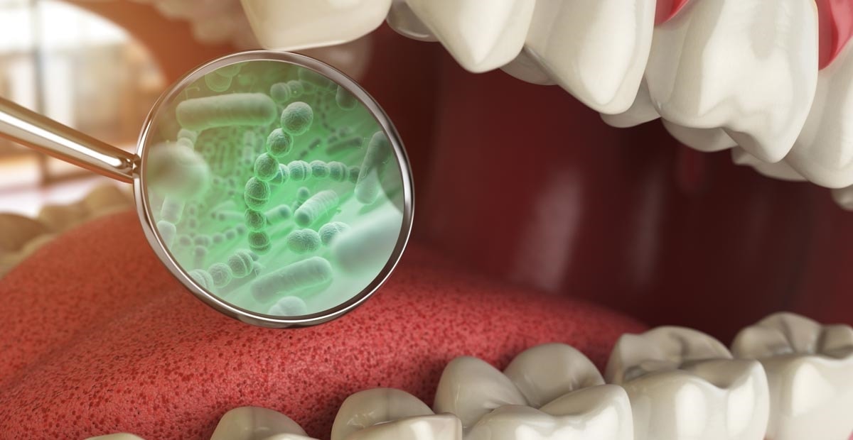 Effektive Mikroorganismen (EM) in der Zahnmedizin