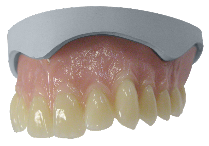 Zahnprothese