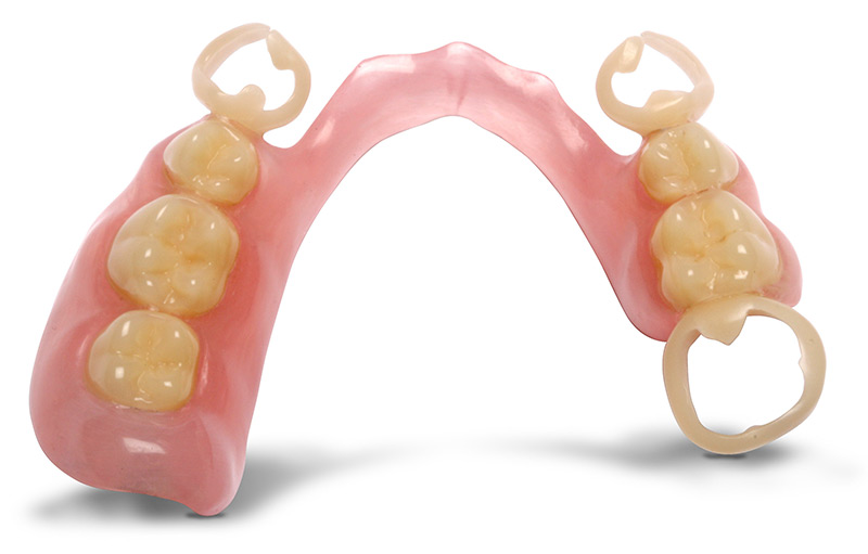 Zahnprothese Befestigung